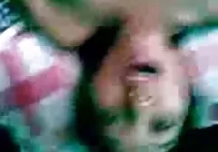1174 سوختگی نوزاد و سوختگی کانال تلگرام فیلم سوپر سکس